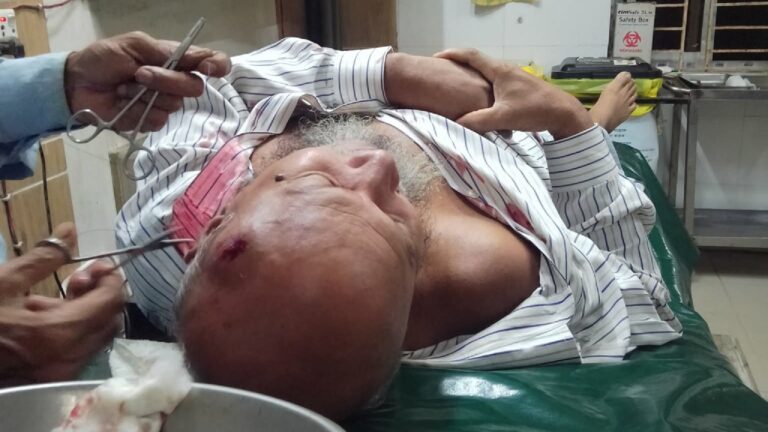 ঈদগাঁওয়ে জুয়ার আসরে বাঁধা দেয়ায় হামলায় আহত বৃদ্ধ মুসল্লি